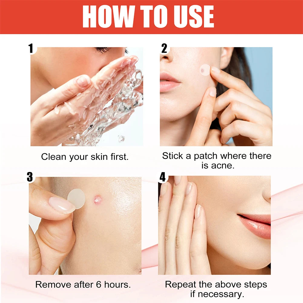 Acne Star/Heart Pimple Patches 240pcs