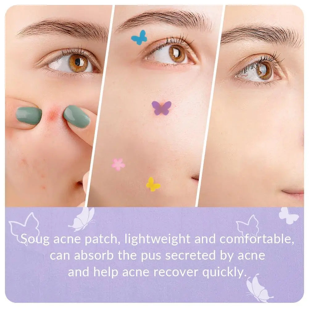 Butterfly Shape Acne Pimple Patches