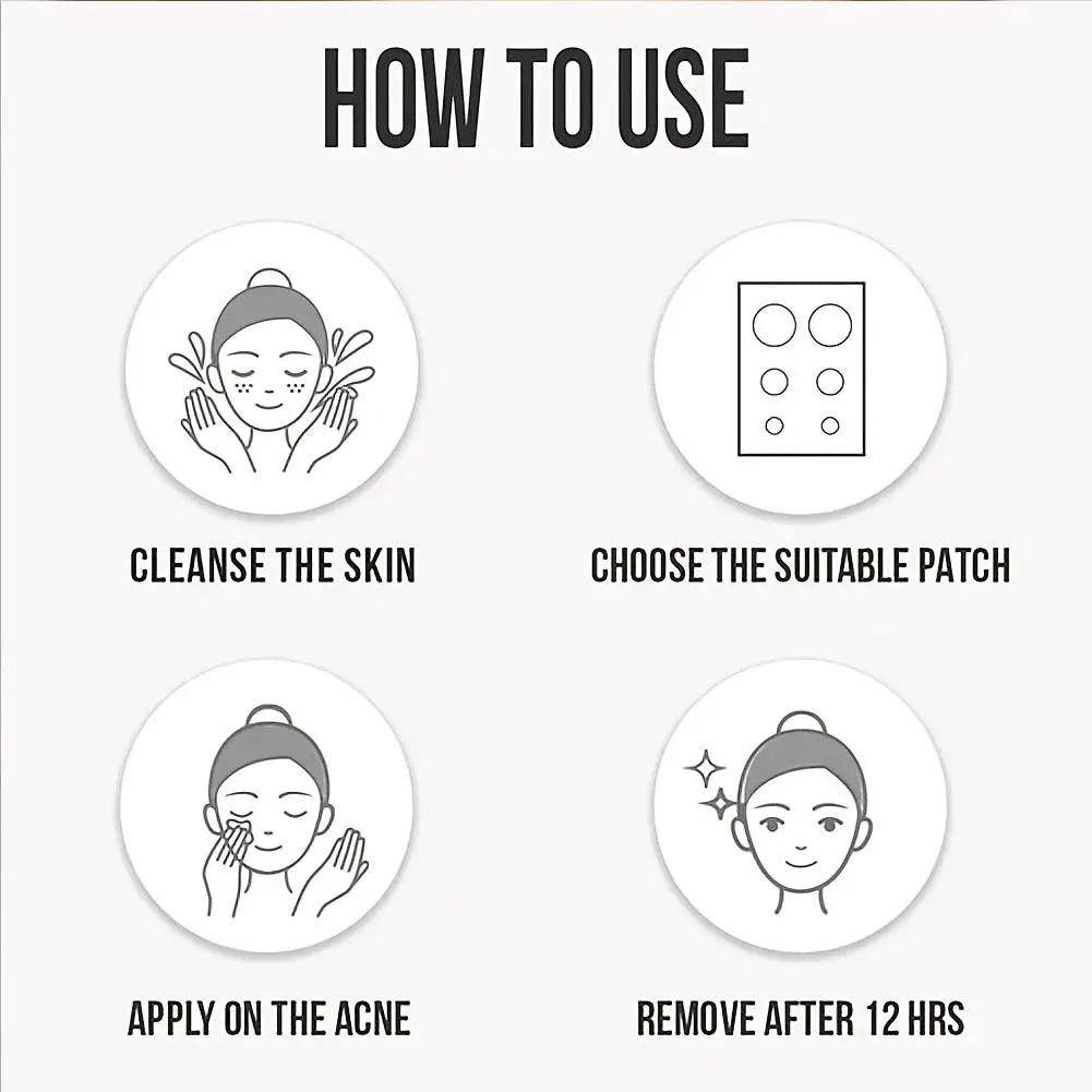 Butterfly Shape Acne Pimple Patches